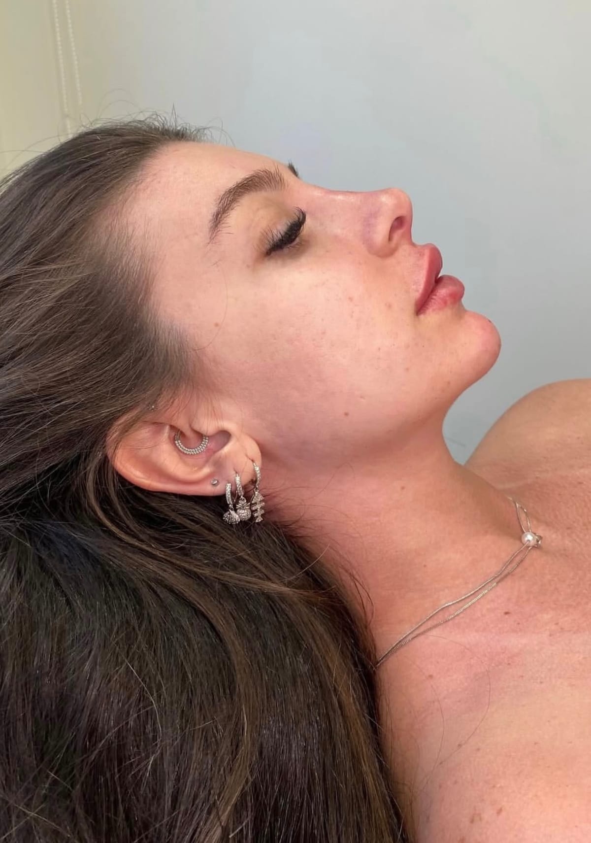 Avaliação de harmonização facial e perfiloplastia no Instituto Canova, em Rio Grande RS
